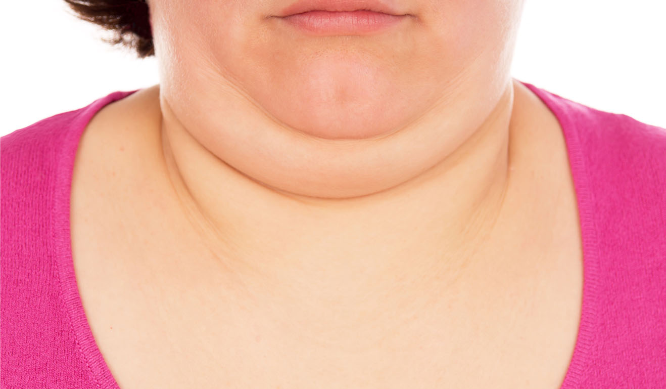 Top 7 Tips On How To Get Rid Of A Double Chin Fast